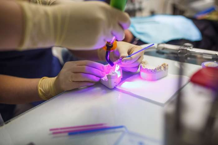 Inlays München Modellierung eines Gebisses