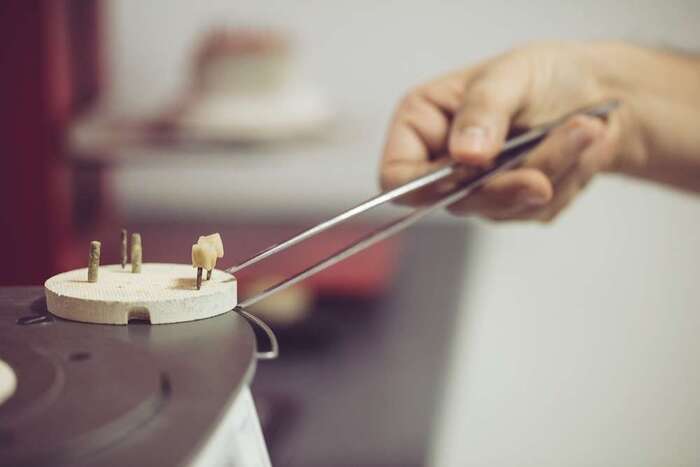 Zahntechnik Krone in Brennofen Dentallabor München Citadelle